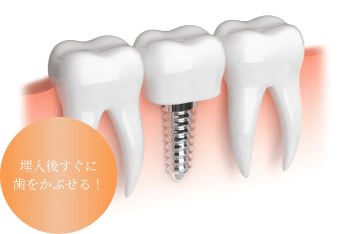 即時荷重に対応