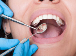 歯医者での検診、初診